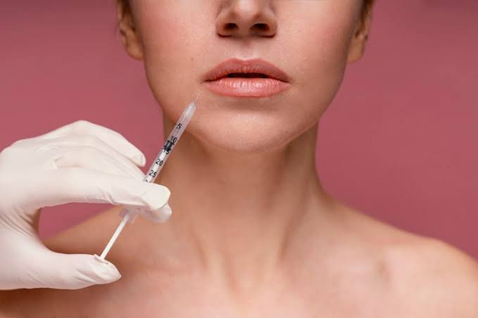 Dermal Fillers London: Everything You Need to Know Before Your Treatment